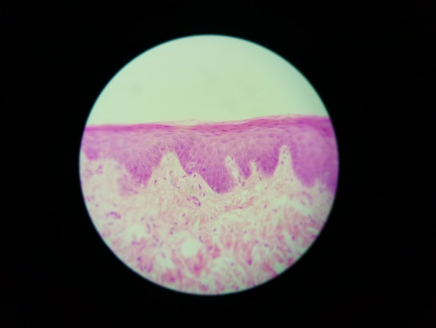 Stratified Squamous Epithelium Slides - Stratified Squamous Epithelium 05 400X